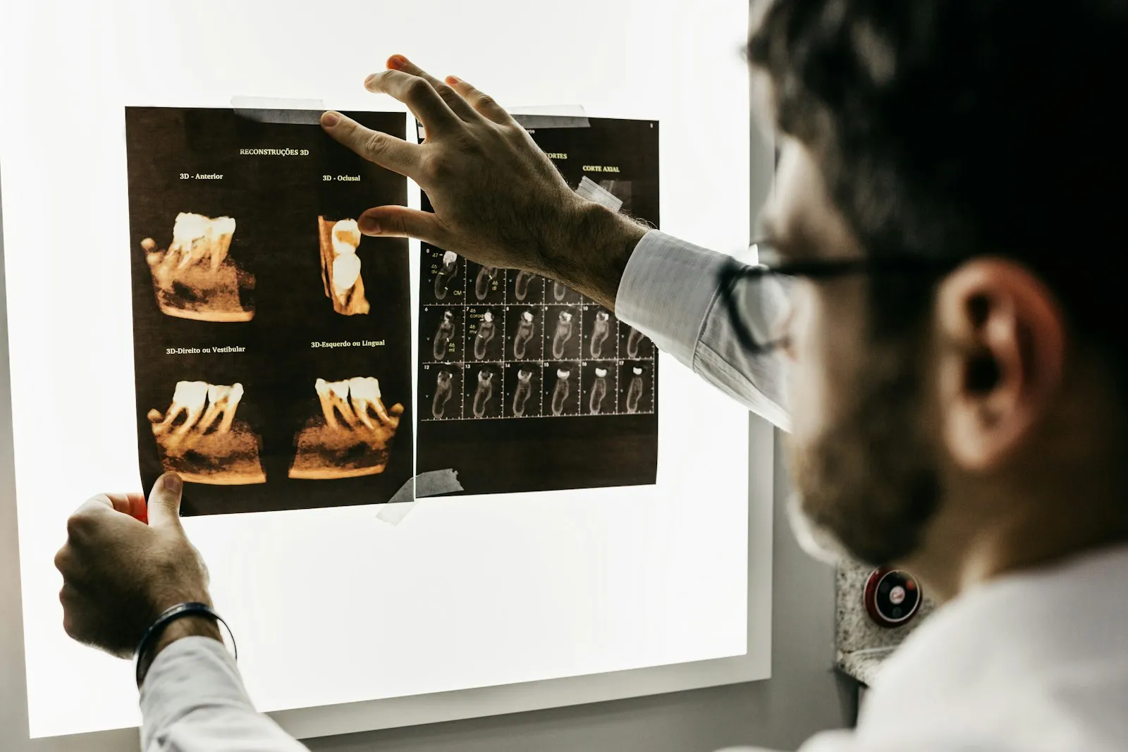 Tannlege analyserer 3D CBCT-skann på dataskjerm for implantatdiagnostikk
