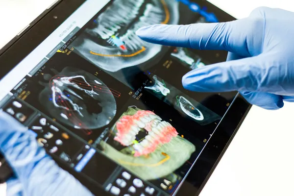 Moderne CBCT 3D-røntgenmaskin og digital panoramarøntgen i tannklinikk